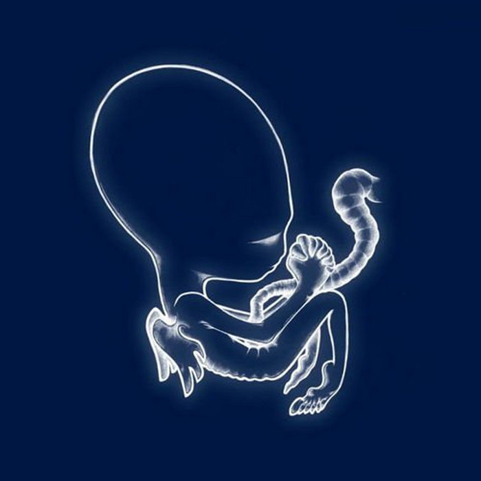 Sigur Rós